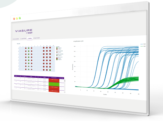 Software Viasure V-Smart para análisis e interpretación de los ensayos ...